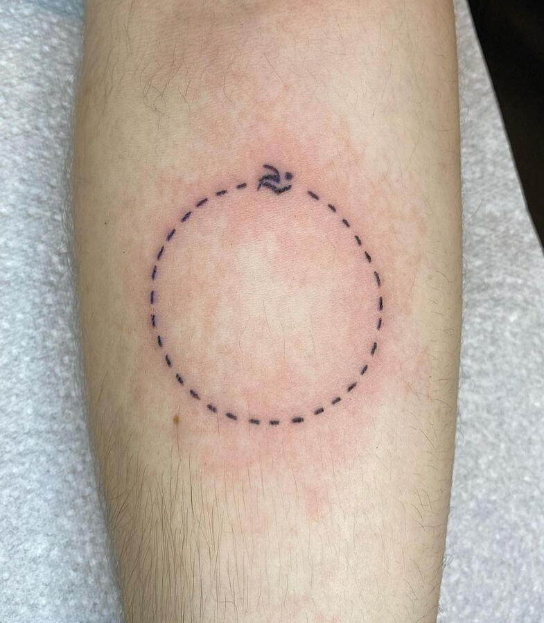 circle stick and poke tattoo Dublin